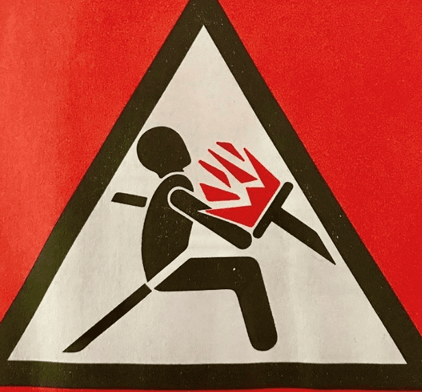 Airbag Burns And Other Injuries