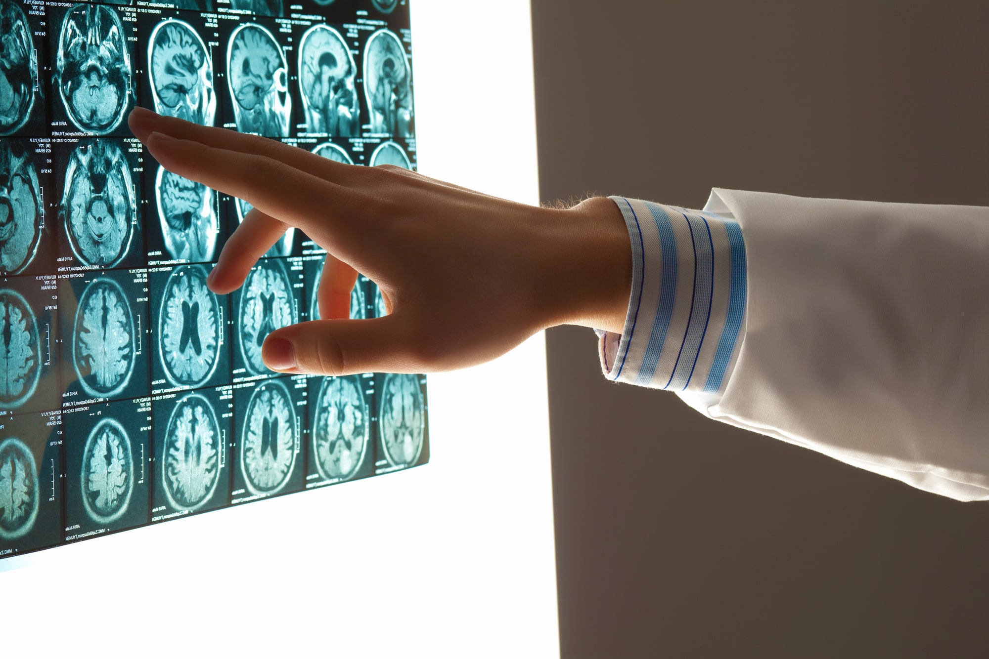 Concord Brain Injury Lawyer